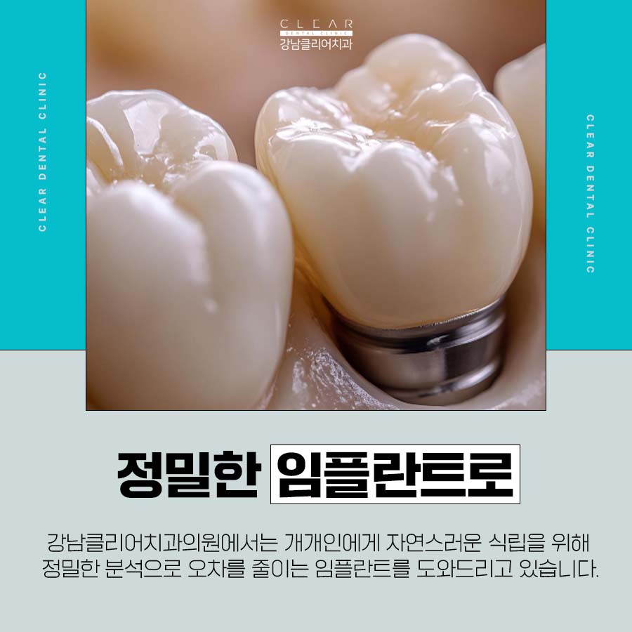 강남역 치과 임플란트 구조와 치료기간 관련 이미지 5