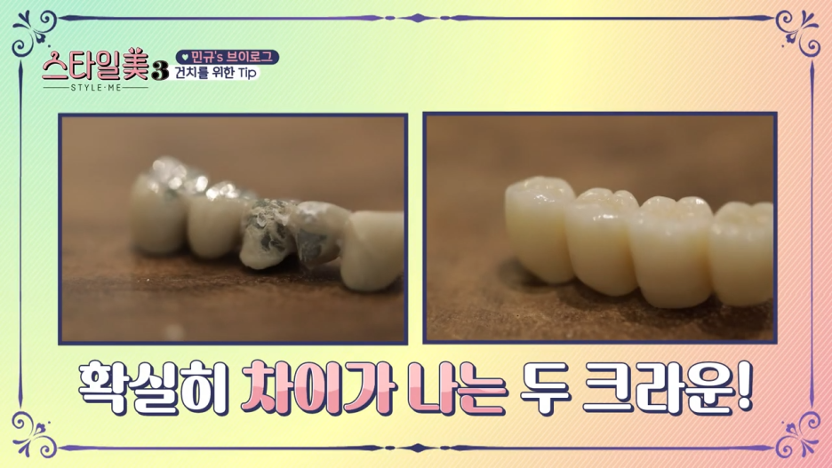 건치를 위한 꿀팁 충치치료부터 시작해요 관련 이미지 6