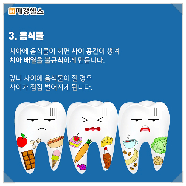 클리어 치과 상식 - 앞니 부분교정 전 꿀팁! 관련 이미지 8