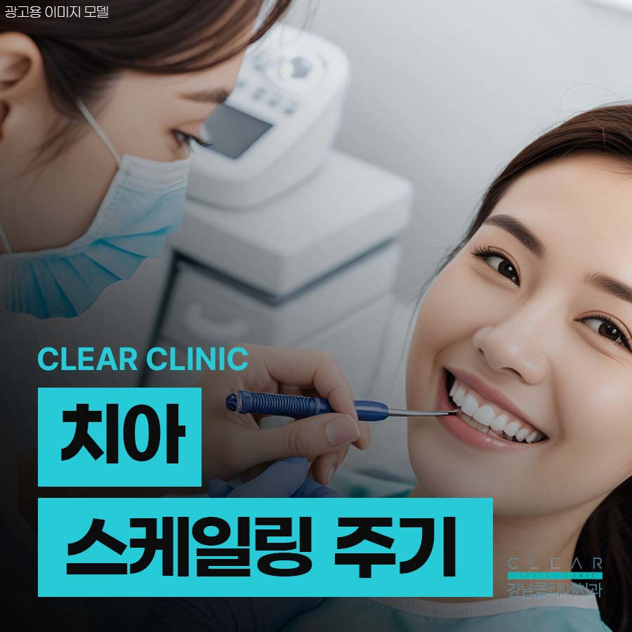 치아 스케일링 주기 치석관리를 위해서 관련 이미지 1