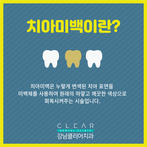 강남치아미백 하얗고 깨끗한 치아로 자신 있는 미소 관련 이미지 2