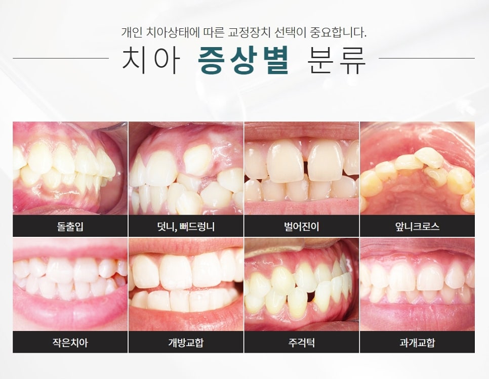 클리어치과 클리피씨 이 곳에서 한다면? 관련 이미지 7