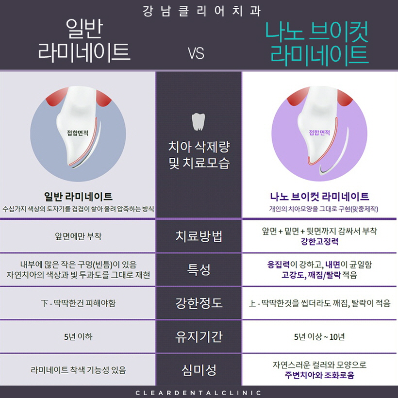 강남역라미네이트 간단히 결정말고 비교하고 따져보세요 관련 이미지 6