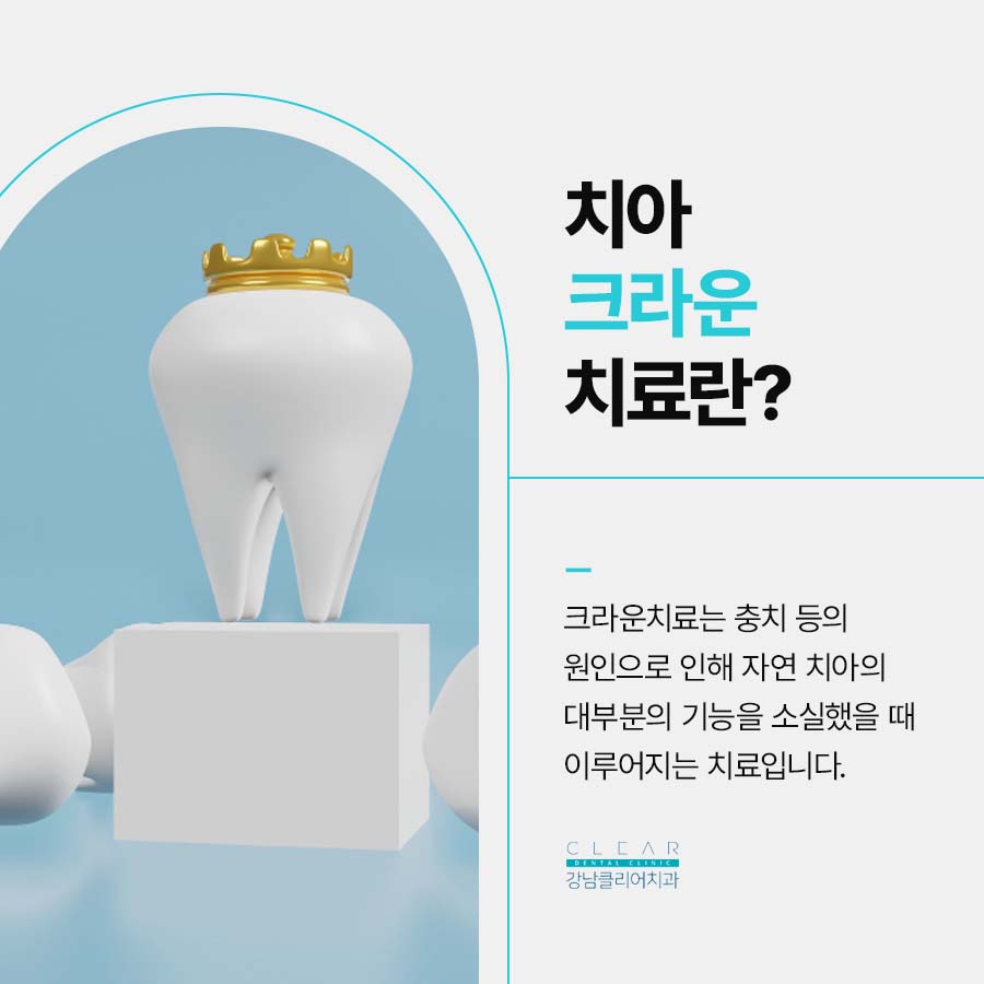 치아보철치료 크라운 치료가 필요한 경우는 관련 이미지 2