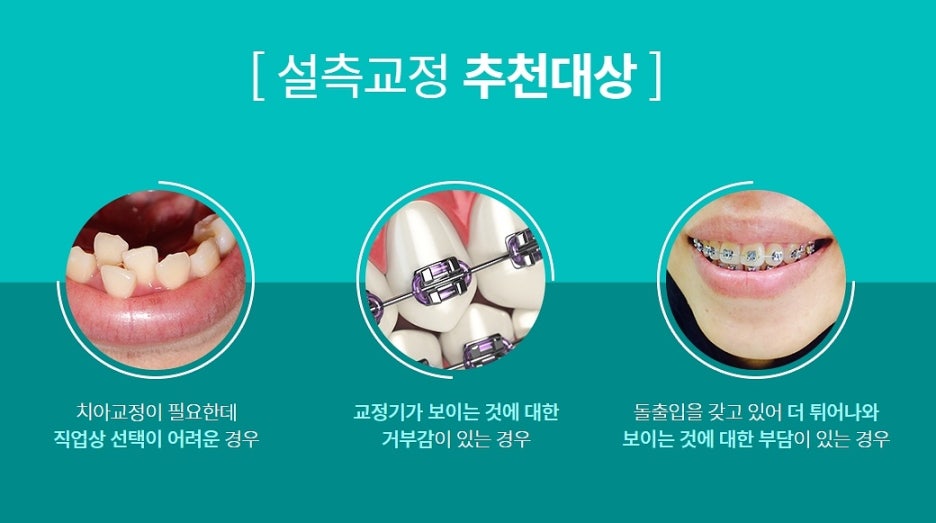 강남 설측교정 병원을 여기서 한다면? 관련 이미지 5