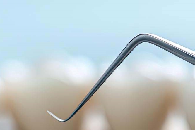 임플란트 구조 수명은 어느정도? 관련 이미지 17