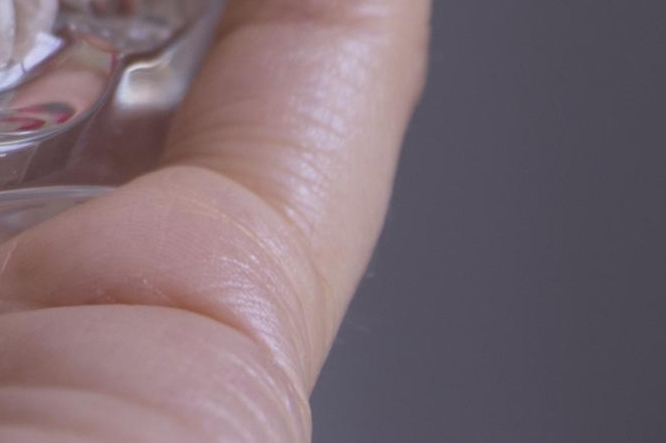 당일 임플란트 조건 무엇이 필요할까 관련 이미지 24