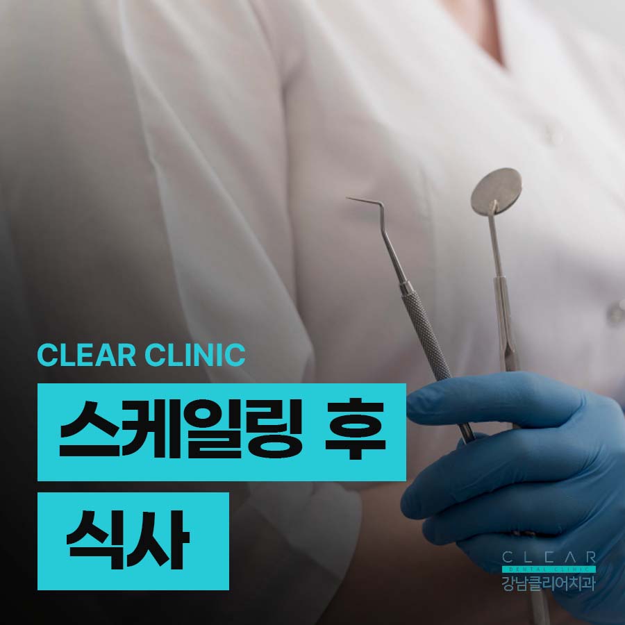 스케일링 후 식사 언제부터? 권장주기는? 관련 이미지 1