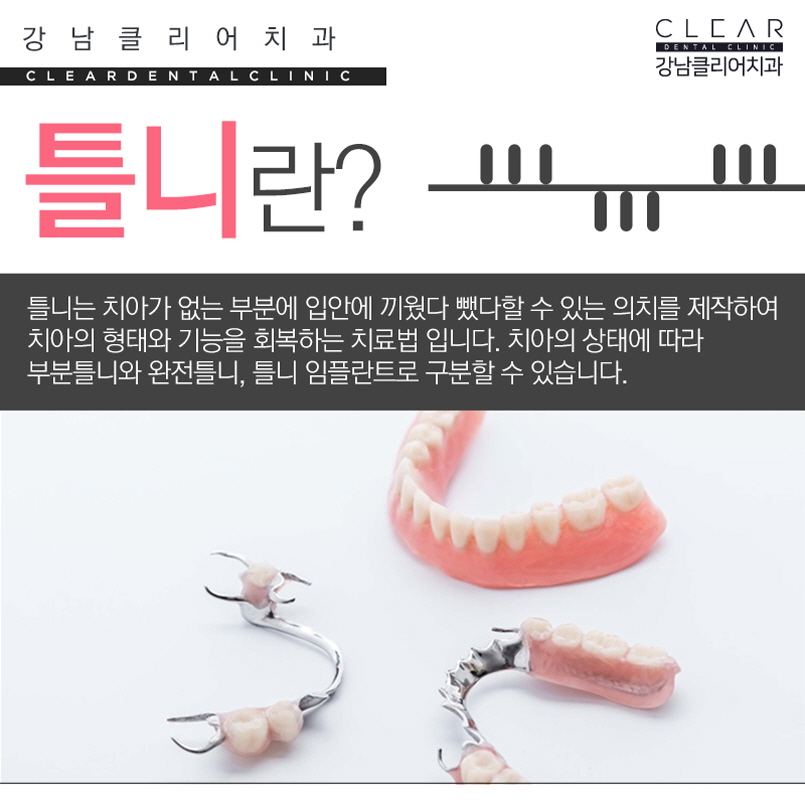 노인 틀니 임플란트틀니 가격 부담줄이기 관련 이미지 2