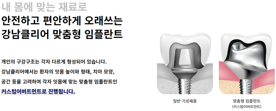 강남임플란트잘하는치과 결과를 예측한 치료 관련 이미지 7