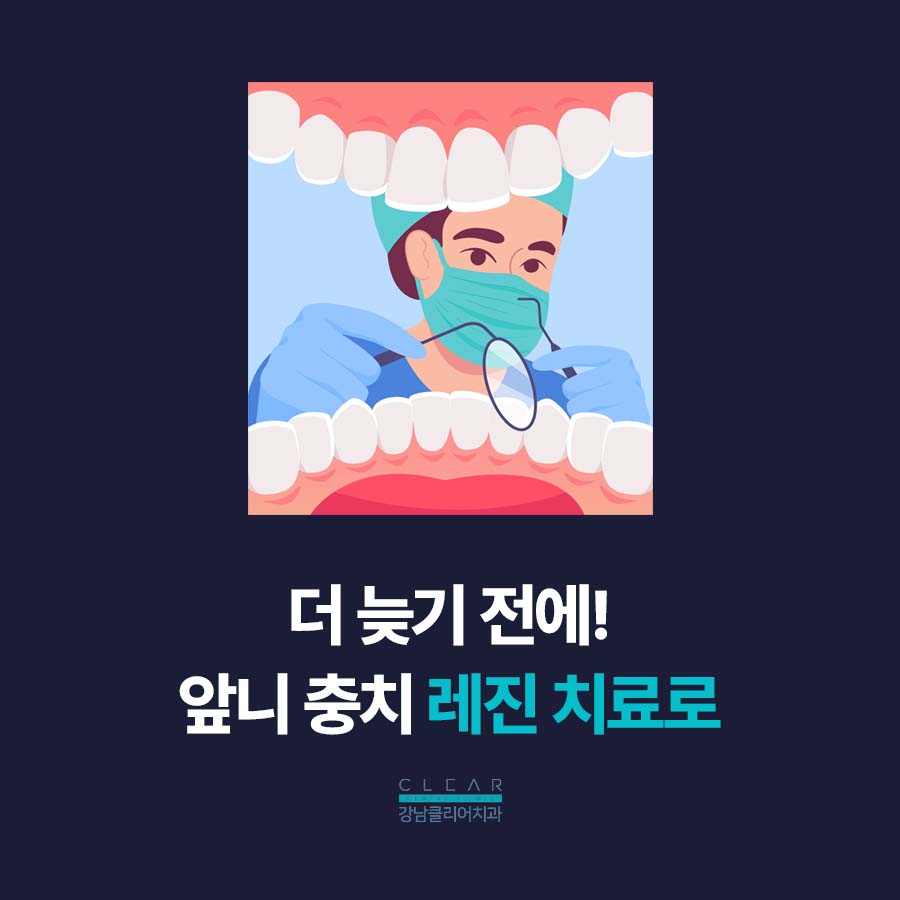 앞니 충치 레진 치료 자연스러워야 하니까 관련 이미지 4