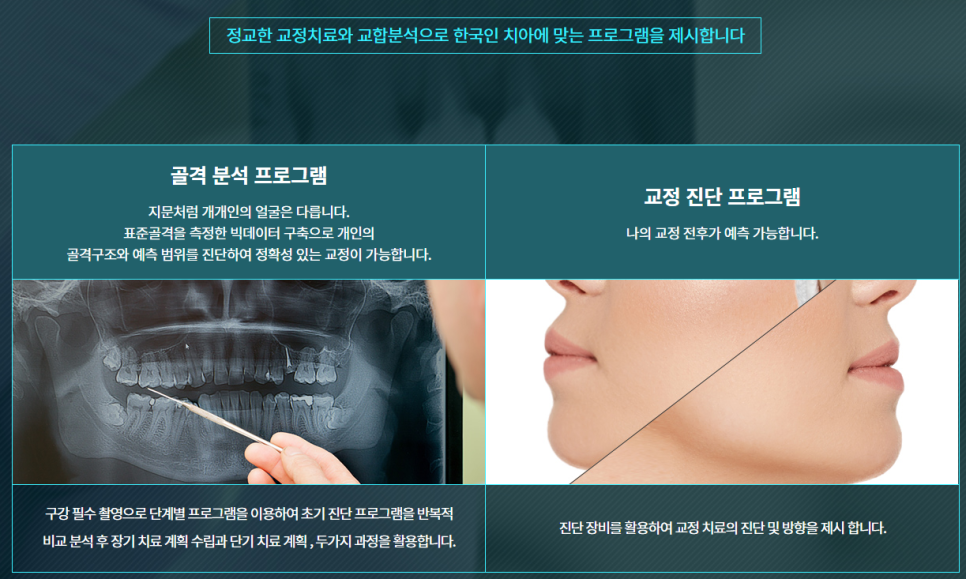 서초동교정치과 반듯한 치아가 부럽다면? 관련 이미지 8