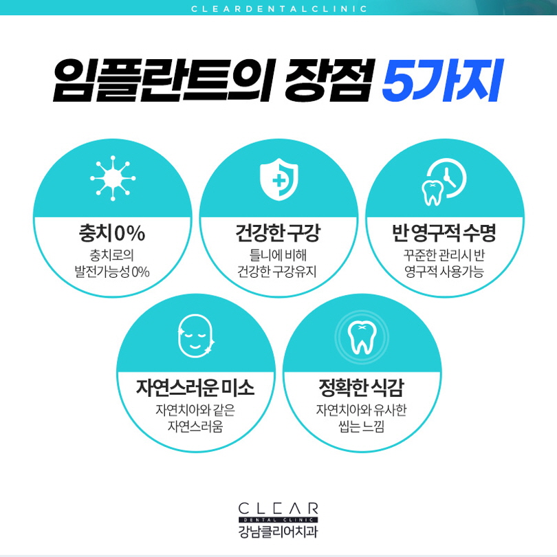 스트라우만임플란트 궁금한 부분 알아보기 관련 이미지 6