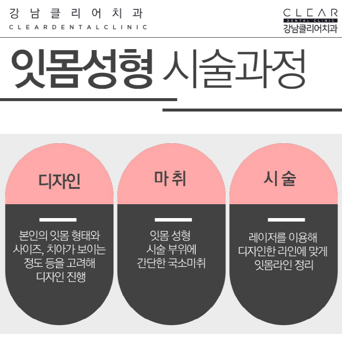 연예인잇몸성형, 잇몸성형 자신감 있는 미소 되찾기 관련 이미지 5