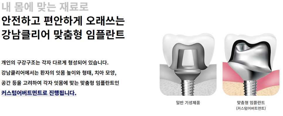 논현동임플란트치과 풍부한 식립 경험으로 관련 이미지 3
