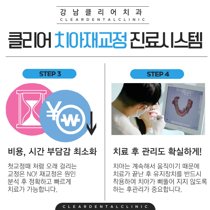 강남 치아재교정 치과 빠르고 확실하게 관련 이미지 5