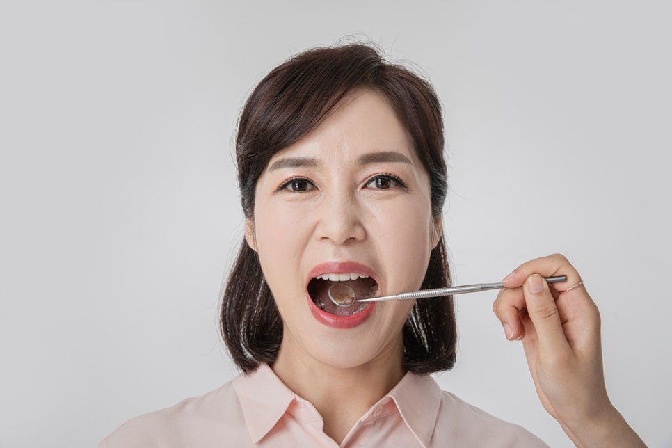 클리어치과 임플란트 비용 후기 찾는다면 관련 이미지 6