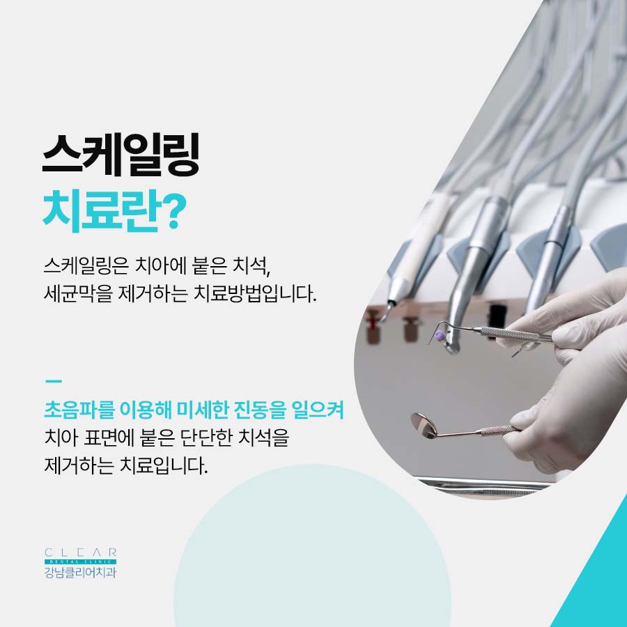 스케일링 피 원인 치료방법에 대해 관련 이미지 2