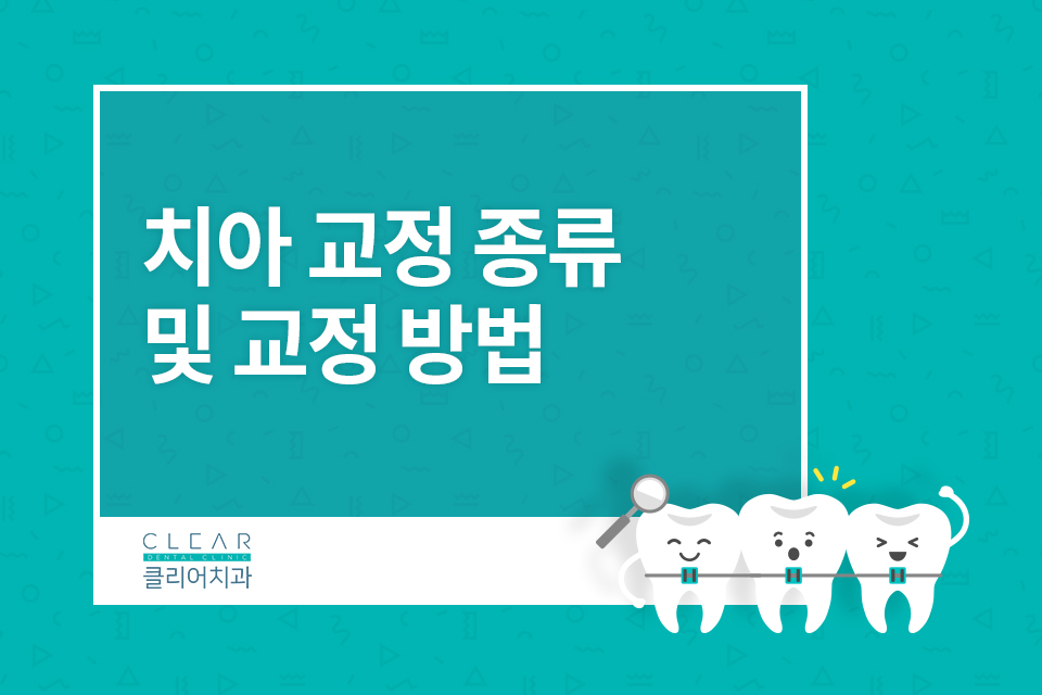 치아 교정 종류 및 교정 방법 관련 이미지 1