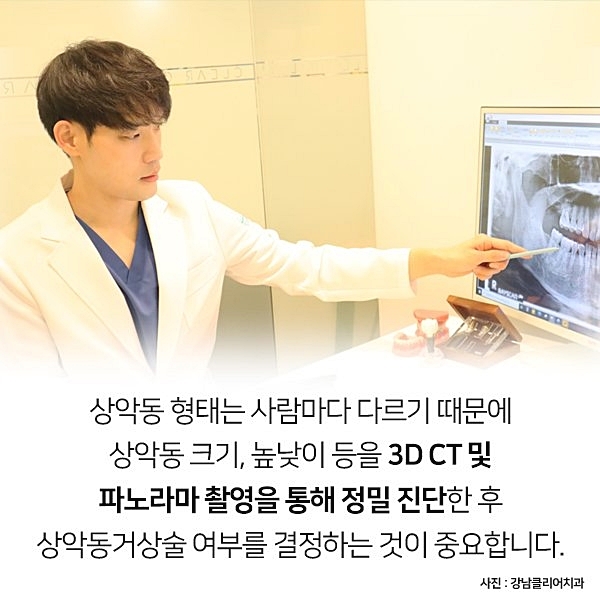 잇몸뼈가 부족해 임플란트 수술 어렵다면? 관련 이미지 10