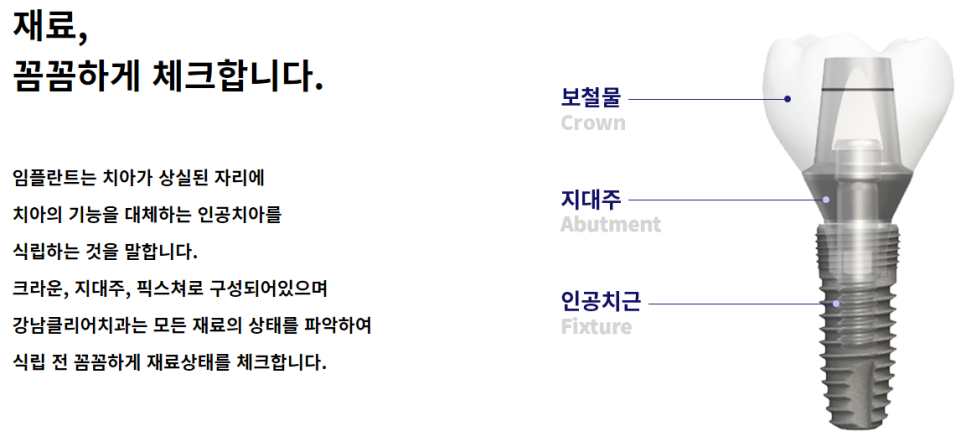 강남역임플란트 건강한 치아를 유지하기 위해서 관련 이미지 5