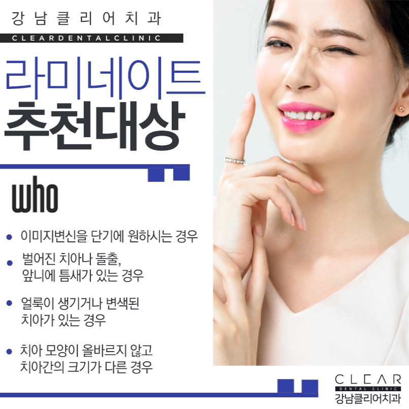 강남라미네이트 강도 고정력 유지기간 중요 관련 이미지 3