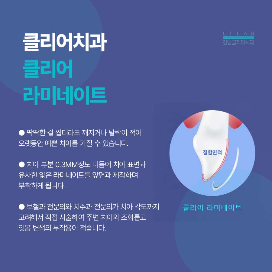 논현동 라미네이트 주의사항 꼭 알아야해요 관련 이미지 5