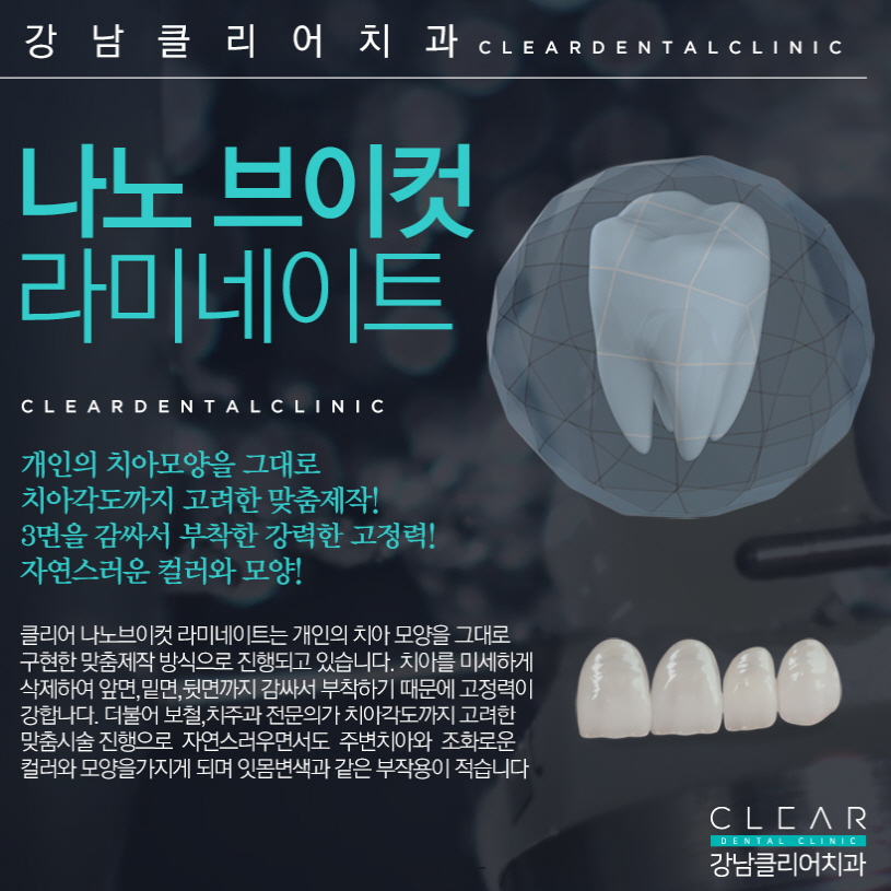 강남 치아라미네이트 개인의 치아모양 그대로 관련 이미지 10
