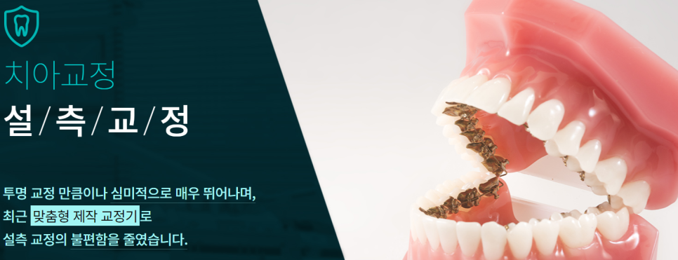 강남역치아교정치과 내 치아에 맞는 방법은? 관련 이미지 3
