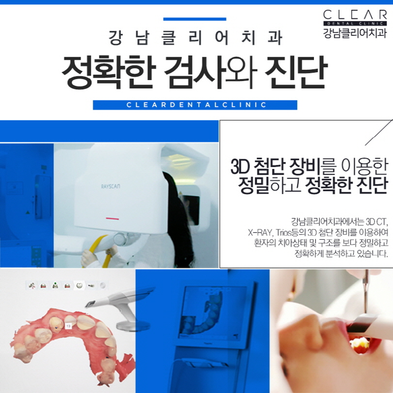 강남역 투명교정 가격 후기 치과 투명교정치료 모든것 관련 이미지 3