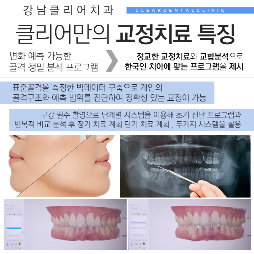 강남 클리피씨교정 잘하는곳 알려드려요. 관련 이미지 6