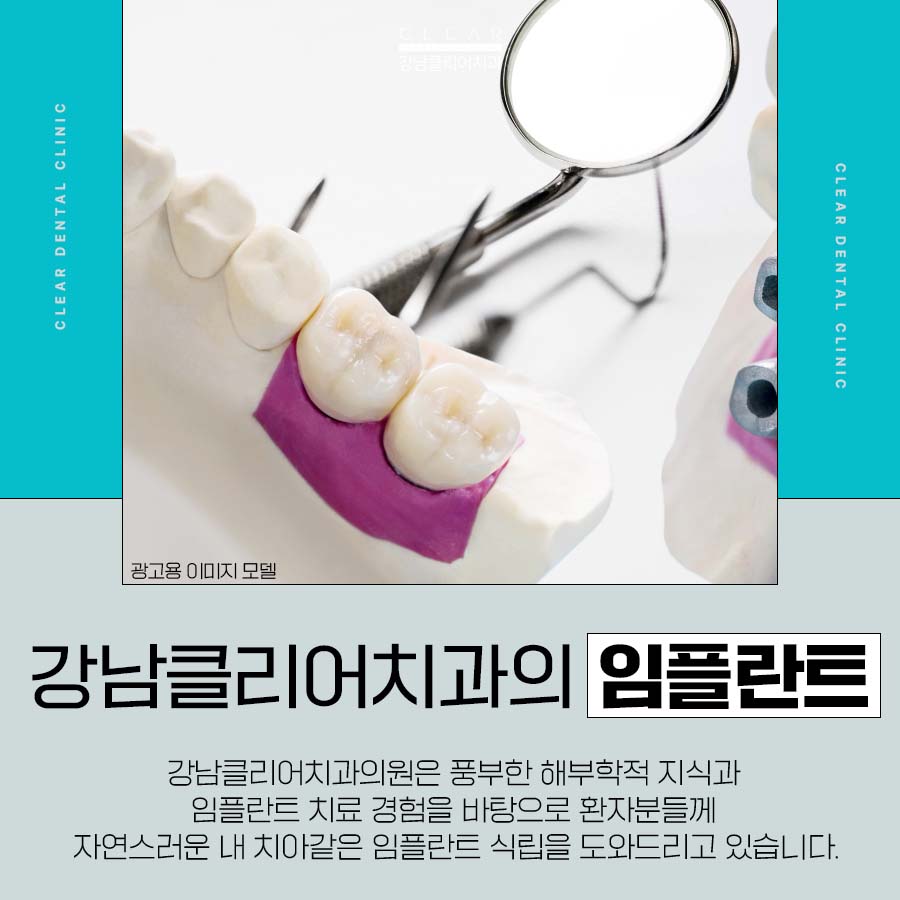 논현역 임플란트 치과 잇몸뼈가 좋지 않아도 관련 이미지 2