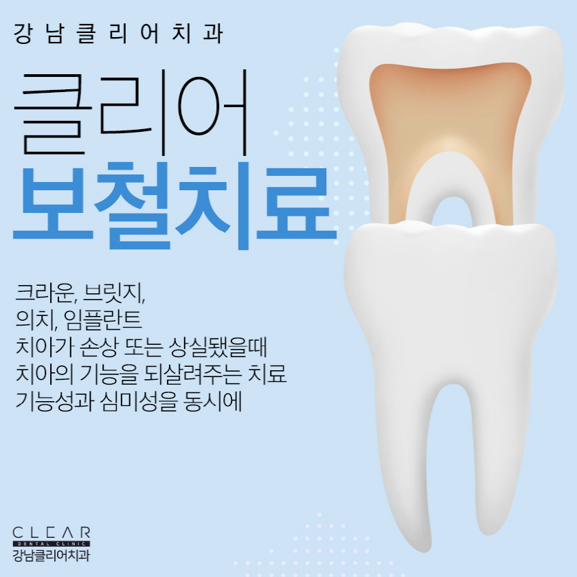 강남역보철치료 내가 가지고 있는 자연치아를 보호하기 관련 이미지 1