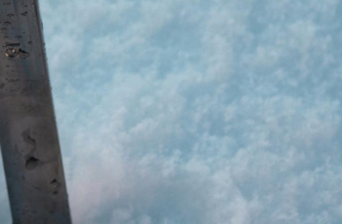 뇌졸중 초기증상 원인 및 골든타임은? 관련 이미지 14