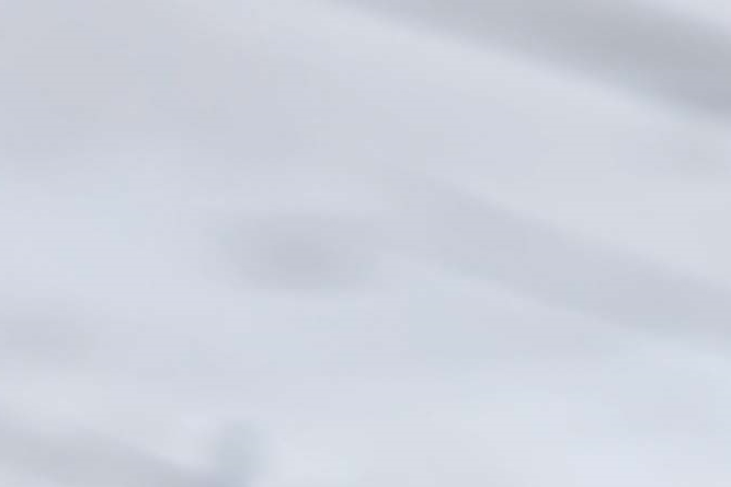 신논현역 치과 치아 신경치료 기간 통증 가격 비교 관련 이미지 17