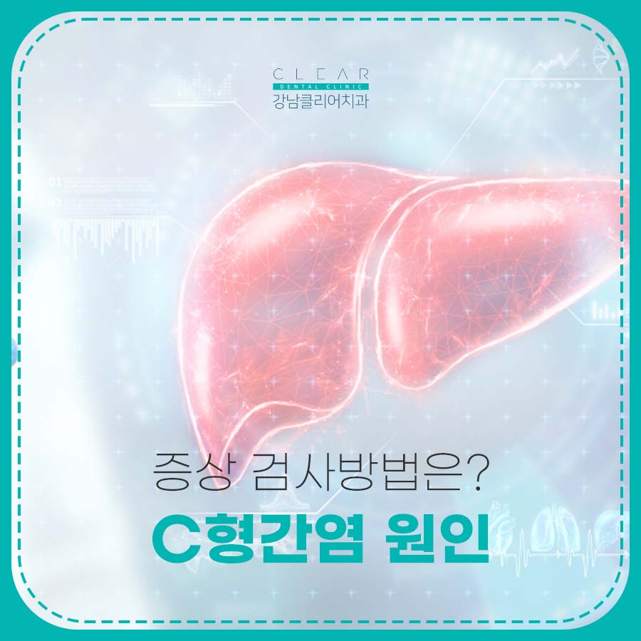 C형간염 원인 증상 검사방법은? 관련 이미지 1