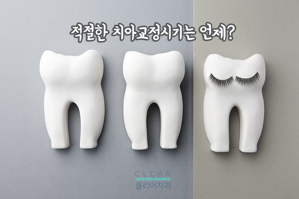 적절한 치아교정시기는 언제부터일까요? 관련 이미지 1