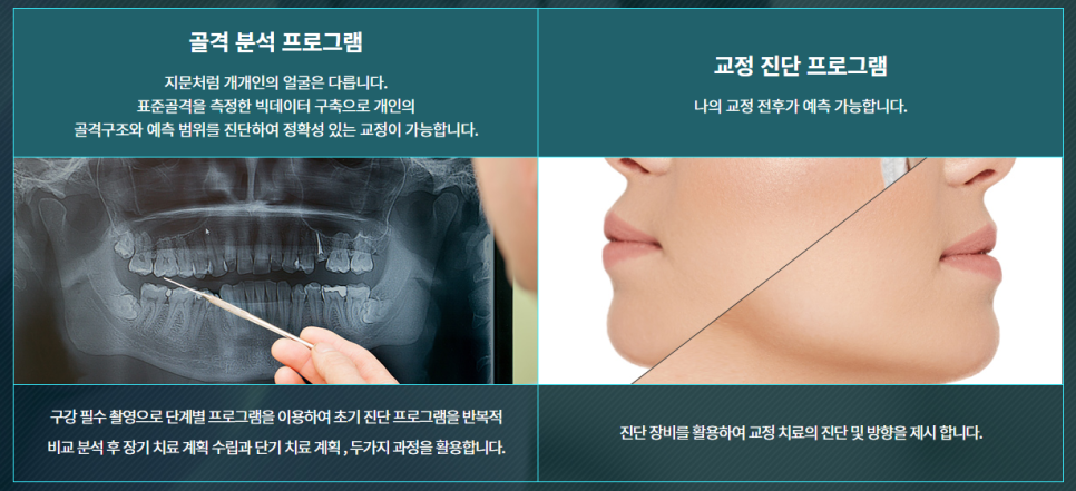 반포동치아교정 반듯한 치아를 갖고 싶다면 관련 이미지 7