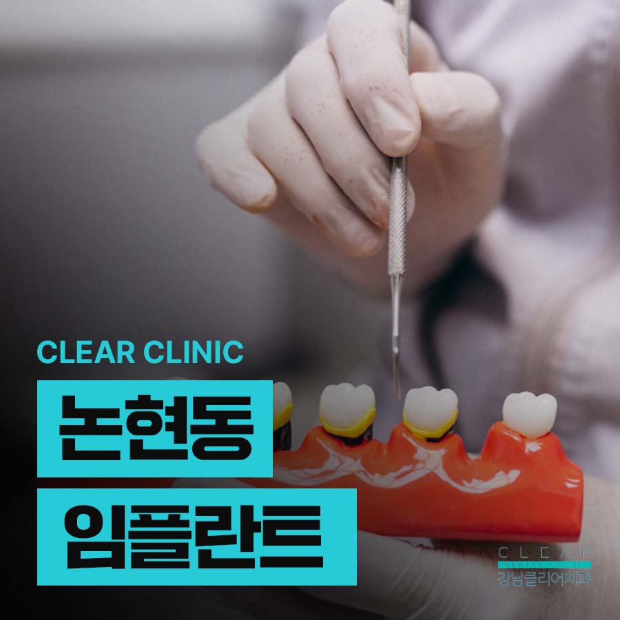 논현동 임플란트 주위염 증상 예방법 관련 이미지 1