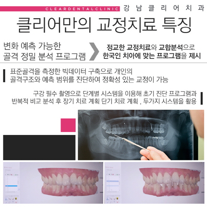 클리피씨교정비용 가격 이벤트로 혜택받기 관련 이미지 5