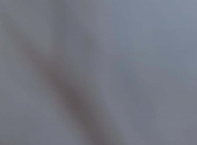 왼쪽 아랫배 딱딱 통증 원인은?(+설사) 관련 이미지 8
