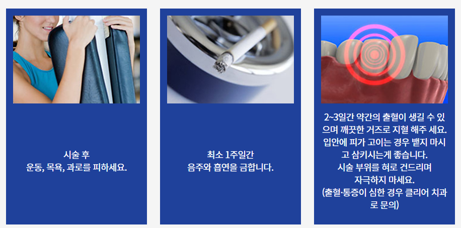 강남임플란트가격 만족스러운 선택은? 관련 이미지 8
