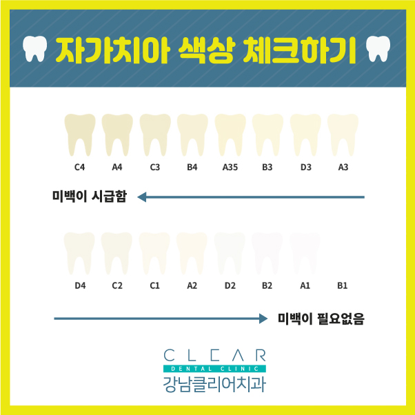 강남치아미백 하얗고 깨끗한 치아로 자신 있는 미소 관련 이미지 4