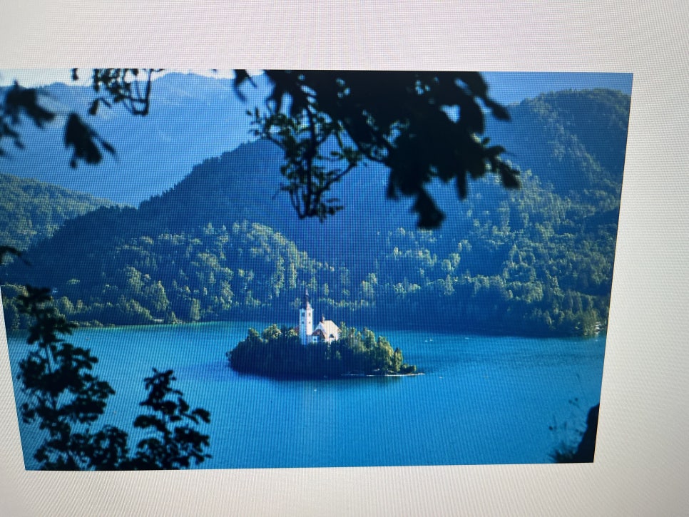 강남임플란트잘하는치과 결과를 예측한 치료 관련 이미지 22