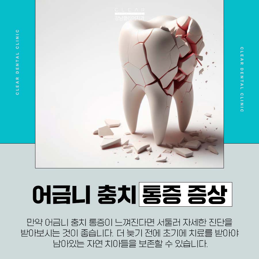 어금니 충치 통증 더 늦기 전에 시작해야 관련 이미지 2