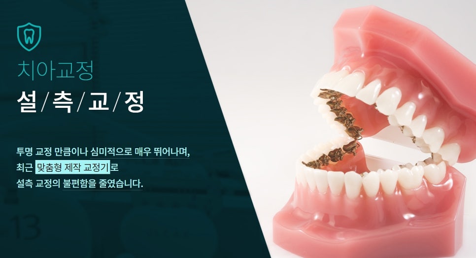 클리어치과 강남역 교정치과 찾는다면? 관련 이미지 2