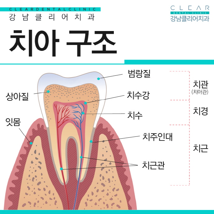 치아 신경치료 과정 소중한 자연치아 살리기 시작 관련 이미지 2