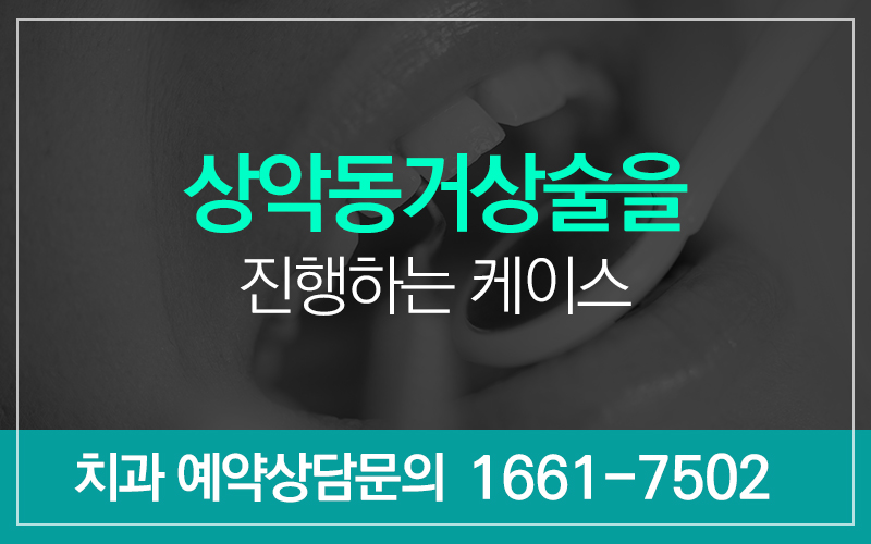 상악동거상술 주의사항 꼭 알아야 해요 관련 이미지 5
