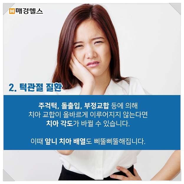 클리어 치과 상식 - 앞니 부분교정 전 꿀팁! 관련 이미지 7