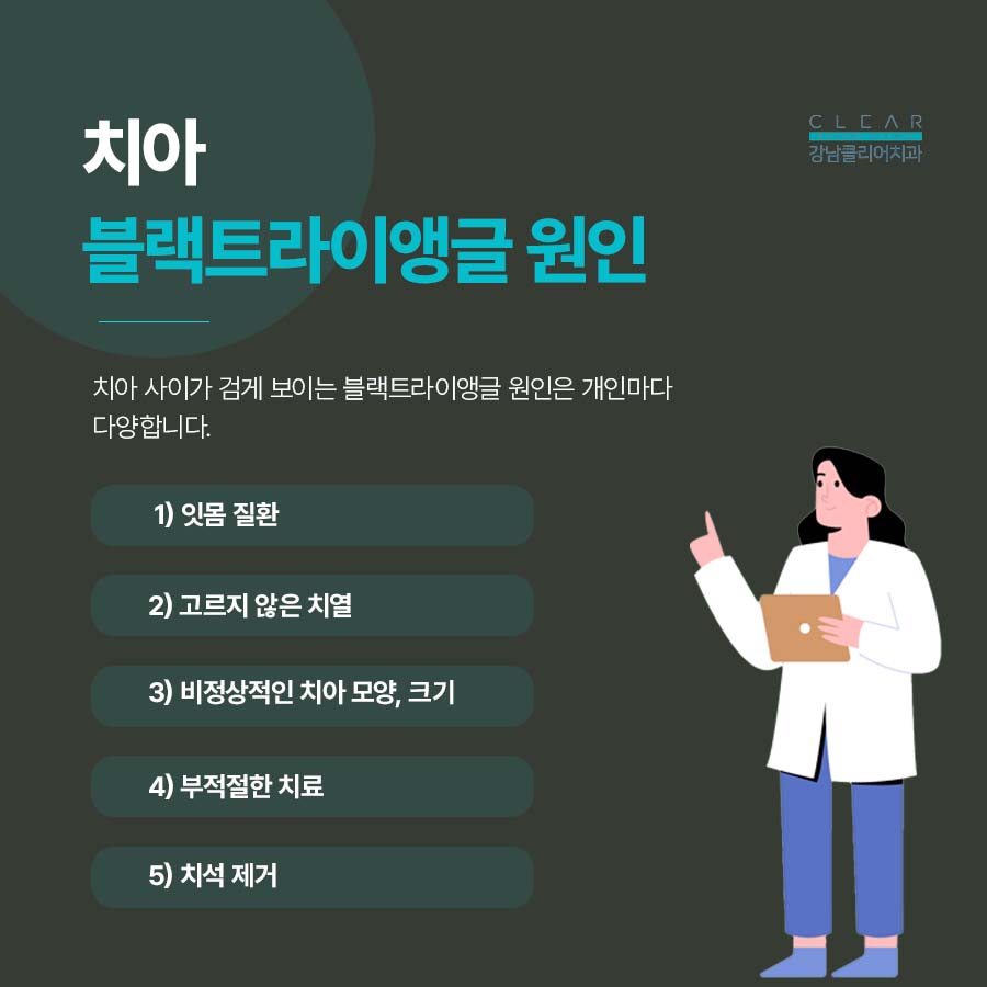 치아 블랙트라이앵글 원인 치료방법은? 관련 이미지 3